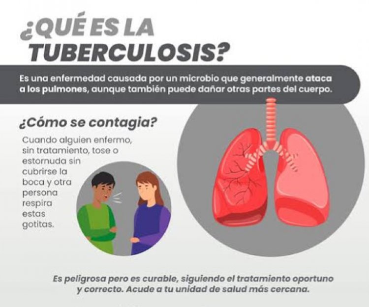 Se promueve la prevención y  tratamiento de tuberculosis