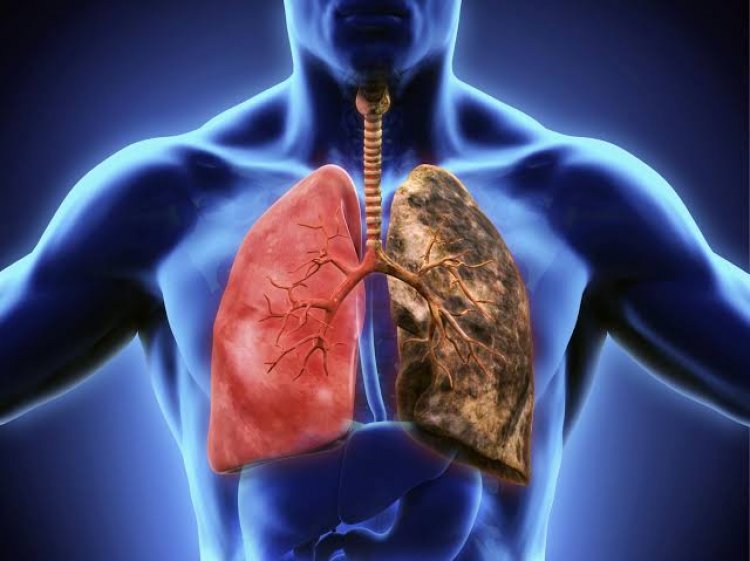 El Hospital General de Cuernavaca  atiende casos de cáncer de pulmón