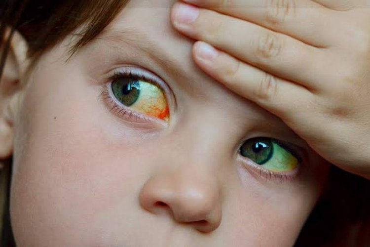 Insisten sobre la higiene para prevenir hepatitis A