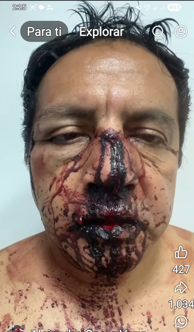 Ya investigan agresión a periodista Fco. Granillo