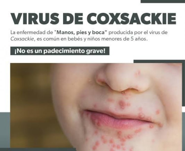 Piden cuidar a niños contra  peligroso virus de coxsackie