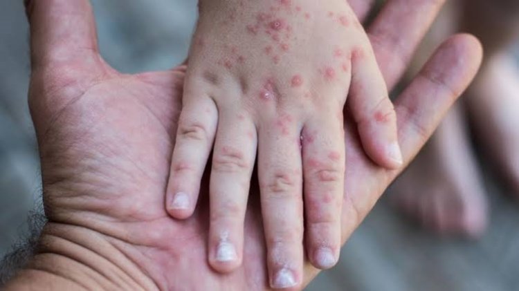 Esta semana, hay clases normales;  falso, rumor sobre una enfermedad