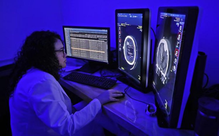 “Tiempo es cerebro”, atención en IMSS  para la enfermedad vascular cerebral